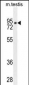 CLPX Antibody (C-term)